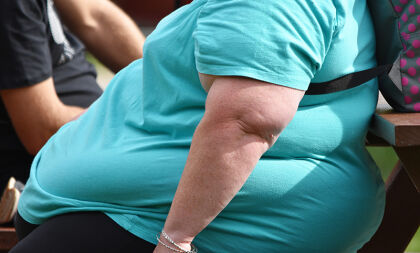Obesidade mórbida é considerada doença crônica para fins de acessibilidade